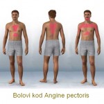 angina_pectoris-bolovi